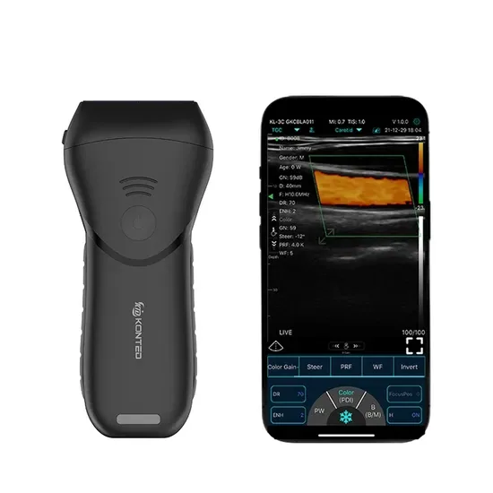 Контед C10MXpro 7.5~10MHz Портативный ручной беспроводной линейный ультразвуковой зонд Портативный дизайн, подходит для поверхностных исследований, с несколькими предустановленными режимами