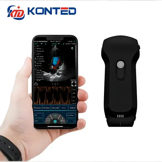 Контед C10RL Двойной головной 3-in-1 Портативный ультразвуковой зонд FDA/CE Беспроводной ручной ультразвуковой сканер высокой четкости